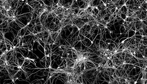 Developing Gene Targeted Therapies and Clinical Trial Readiness for Rare Neurodevelopmental Disorders