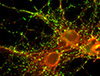 Every time you make a memory, somewhere in your brain a tiny filament reaches out from one neuron and forms an electrochemical connection to a neighboring neuron. VKC investigator Donna Webb heads a team of biologists who study how these connections are formed at the molecular and cellular level.